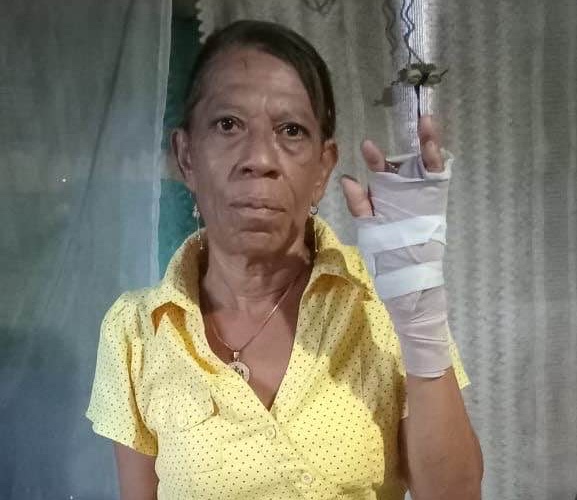 Dama herida en Villa Hermosa, La Romana