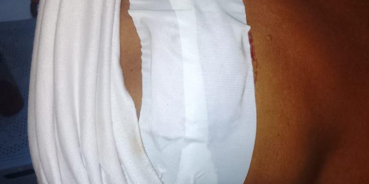 machete heridas